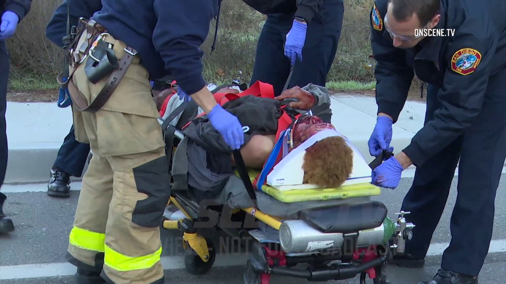 San Diego: Pedestrian Seriously Inured After Being Hit By Car - ONSCENE.TV